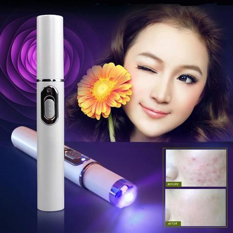 Blue Light Therapy Acne Laser Pen Soft Scar Wrinkle Removal Treatment Device Skin Care Beauty Equipment - Globentra